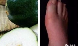 痛风可以吃白瓜,白瓜助力健康饮食